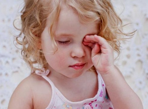 Bệnh đau mắt đỏ ở trẻ